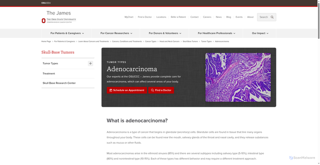 Security scan screenshot of https://cancer.osu.edu/for-patients-and-caregivers/learn-about-cancers-and-treatments/cancers-conditions-and-treatment/cancer-types/head-and-neck-cancers/skull-base-tumors/tumor-types/adenocarcinoma