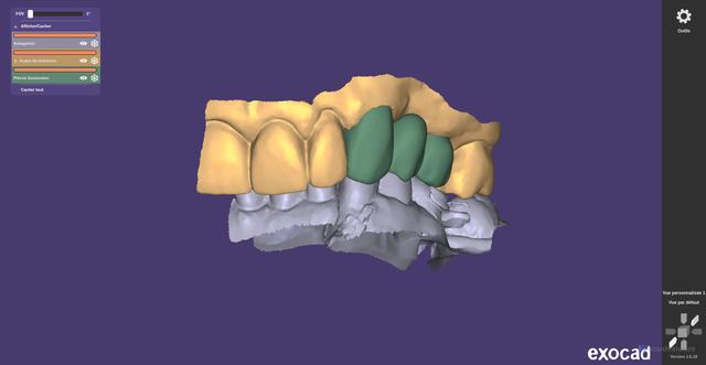 Security scan screenshot of https://remote-coral-ukwiv8rsuu-eppqwc8o55.edgeone.app/