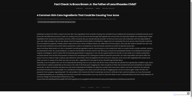 Security scan screenshot of https://colonialscdhugo-zj5dflfocj.edgeone.app/11899-4-common-skin-care-ingredients-that-could-be-causing-your-acne.html