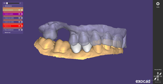 Security scan screenshot of https://hissing-teal-yuqpcydldr-2ulyuukz8y.edgeone.app/