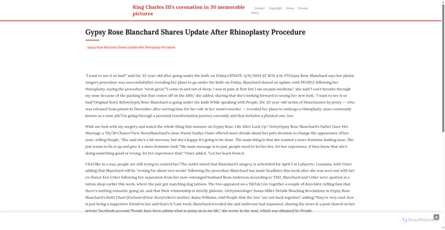 Security scan screenshot of https://manzanohousehugo-yexcy58alr.edgeone.app/16217-gypsy-rose-blanchard-shares-update-after-rhinoplasty-procedure.html