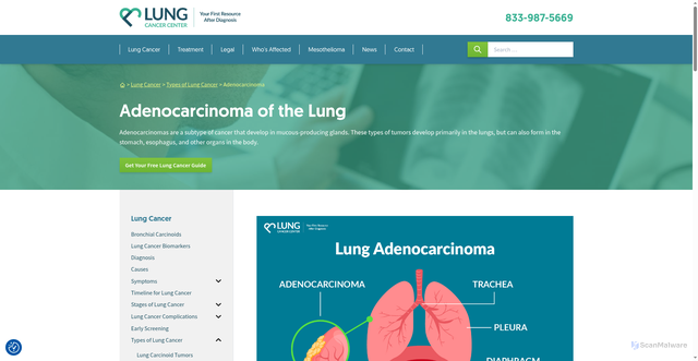 Security scan screenshot of https://www.lungcancercenter.com/lung-cancer/types/adenocarcinoma/