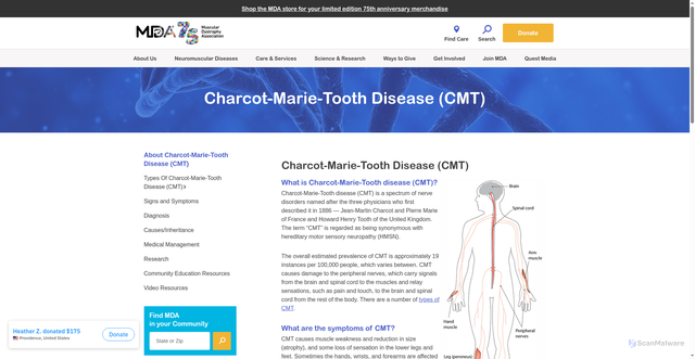 Security scan screenshot of https://www.mda.org/disease/charcot-marie-tooth