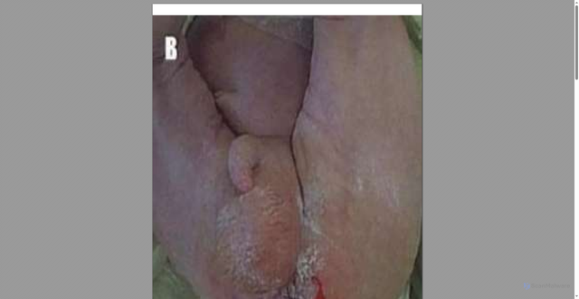 Security scan screenshot of https://biologialeucinose-tne4o01pkp.edgeone.app/