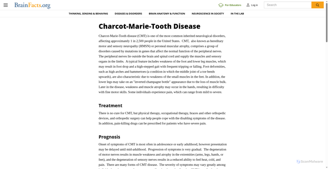 Security scan screenshot of https://www.brainfacts.org/diseases-and-disorders/neurological-disorders-az/diseases-a-to-z-from-ninds/charcot-marie-tooth-disease