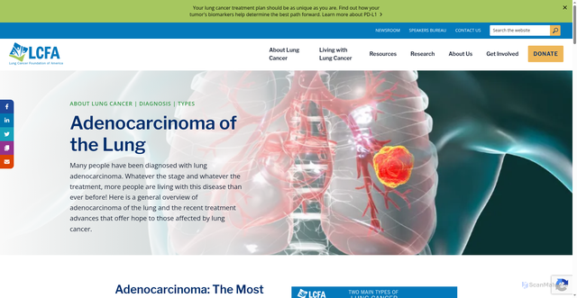 Security scan screenshot of https://lcfamerica.org/about-lung-cancer/diagnosis/types/adenocarcinoma/