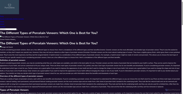 Security scan screenshot of https://cremefraichemarket.pages.dev/the-different-types-of-porcelain-veneers-which-one-is-best-for-you/