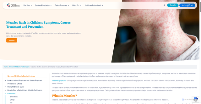 Security scan screenshot of https://nortonchildrens.com/services/pediatrics/measles/